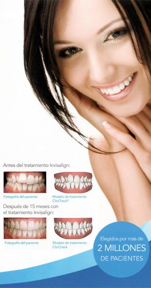 Clínica Dental Pisonero Blanco tratamientos de invisalign 2