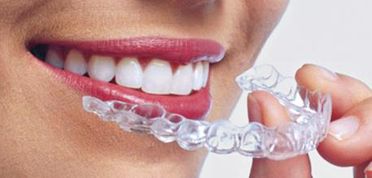 Clínica Dental Pisonero Blanco ortodoncia 3