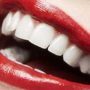 Clínica Dental Pisonero Blanco tratamientos 2